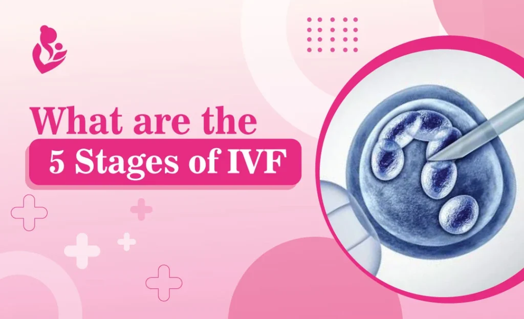 What Are the 5 Stages of IVF